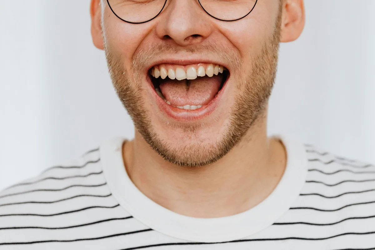 A man laughing, teeth and gums in full view