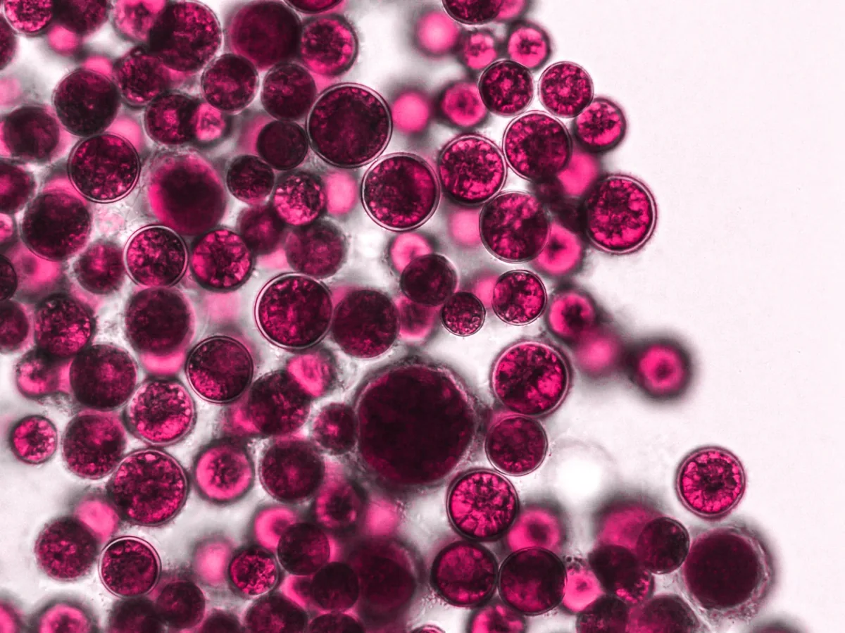 Vaginal microbes in close up under the microscope